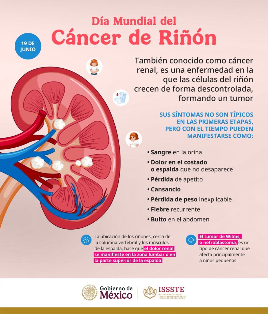 Recomienda ISSSTE cuidar la salud renal para prevenir cáncer 2 ISSSTE 1 3
