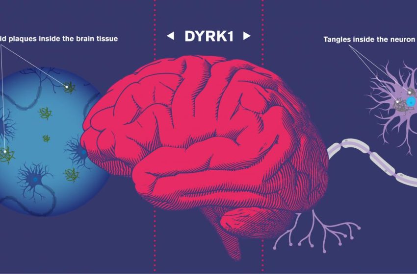 DiaSindromeDYRK1A