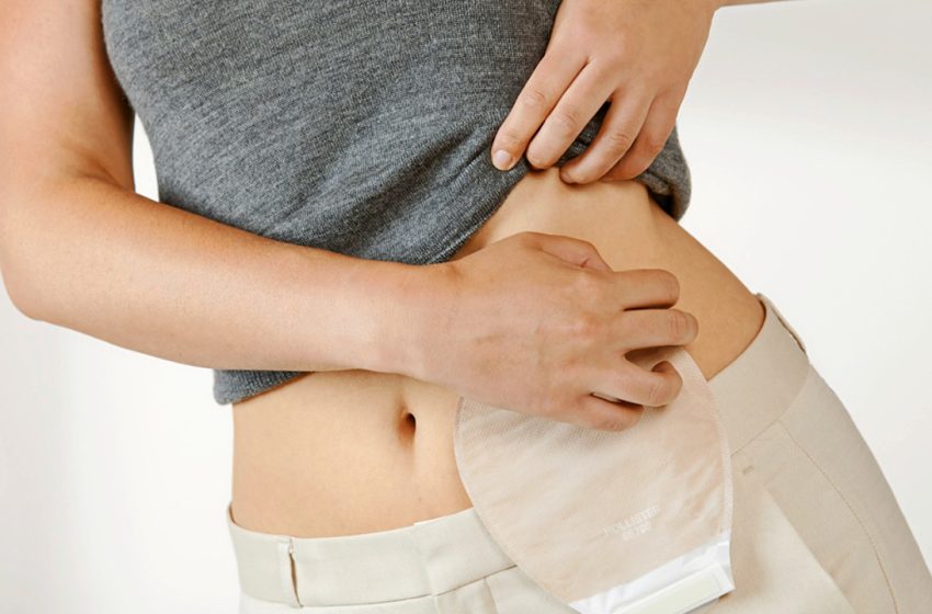  4 de octubre: Día Mundial del Paciente Ostomizado