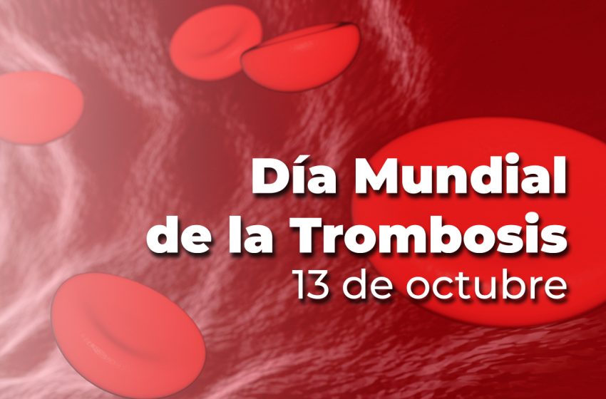  13 de octubre: Día Mundial de la Trombosis