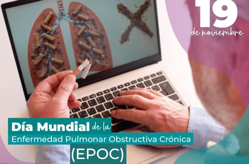 DiaEPOC