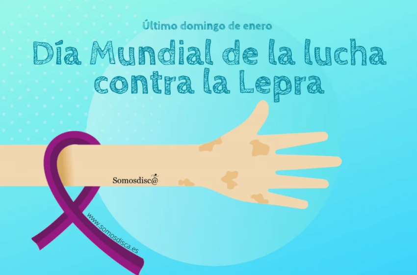  25 de enero (último domingo): Día Mundial contra la Lepra
