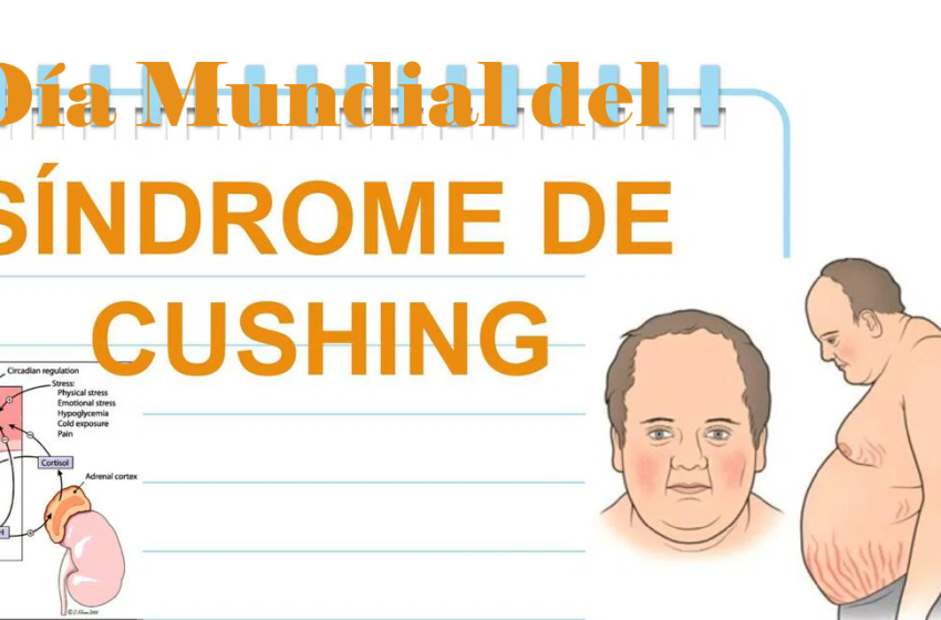  8 de abril: Día Mundial del Síndrome de Cushing