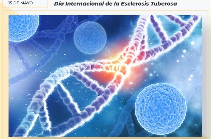 DiaEsclerosisTuberosa