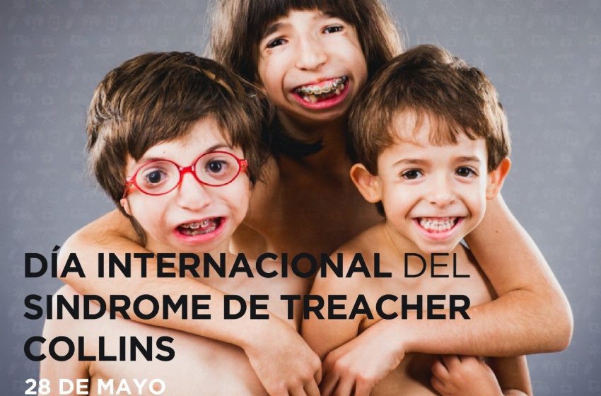  28 de mayo: Día Internacional del Síndrome de Treacher Collins