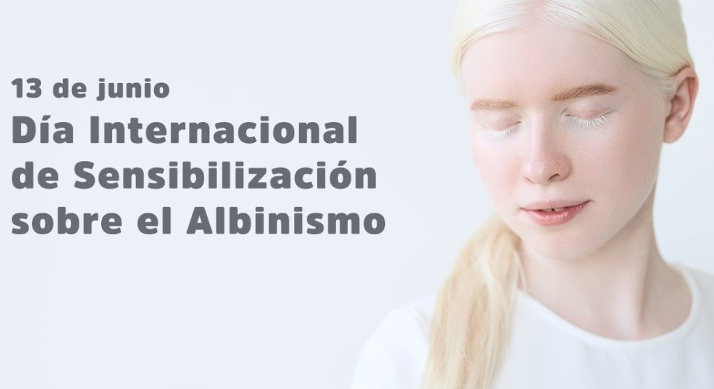 DiaAlbinismo