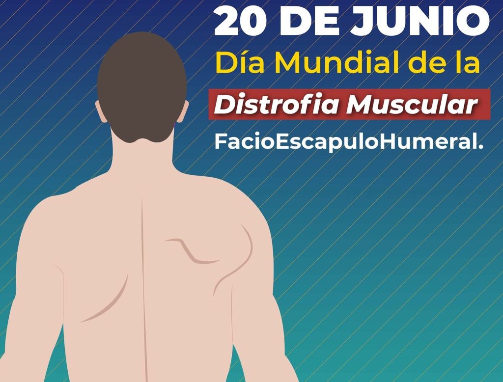 DiaDistroMuscFaEsHu