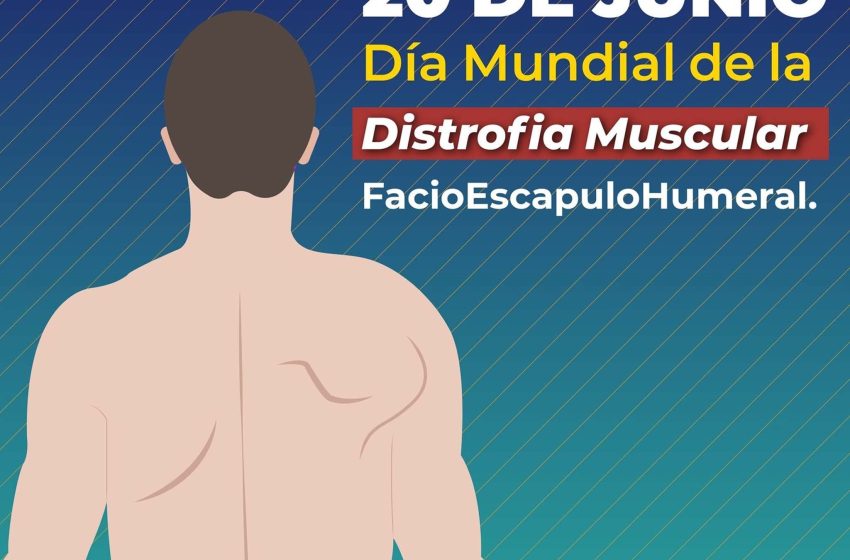  20 de junio: Día Mundial de la Distrofia Muscular FacioEscapuloHumeral